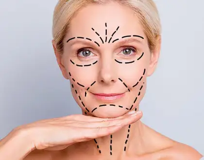 Lifting facial sin cirugía