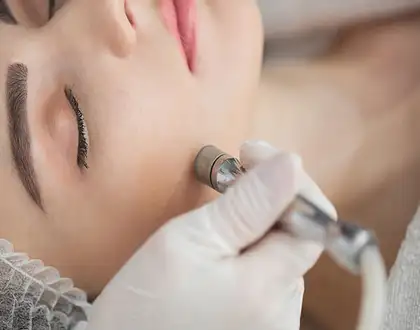 Tratamiento facial de punta de diamante